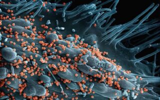Microbiote intestinal